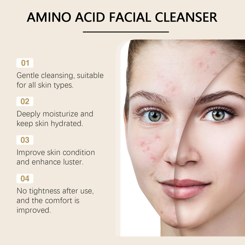 Amino Acid Facial Cleanser – Pore Purifying & Oil Control 100g Amino Acid Cleanser Oasis Select