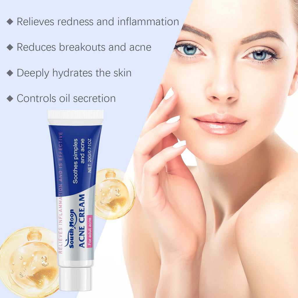 20/40/60g Anti Acne Cream Oil Control Repair Pimple Spot Remove Acne Mark Cleaning Refreshing Moisturizer Skin Pore Shrink Cream Oasis Select