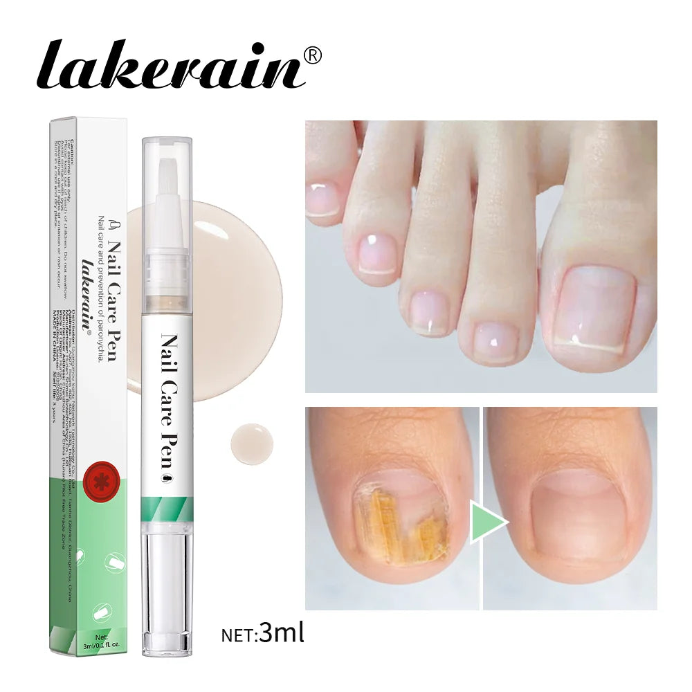 Nail Care Pen Nourish and Moisturize Nails Prevent Fungal Infections Improve Appearance Flat Brush Head Design Daily Nail Care Oasis Select Green