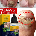 7 Days Nail Repair Serum | Plant Extract Nail Wellness Gel 10ml