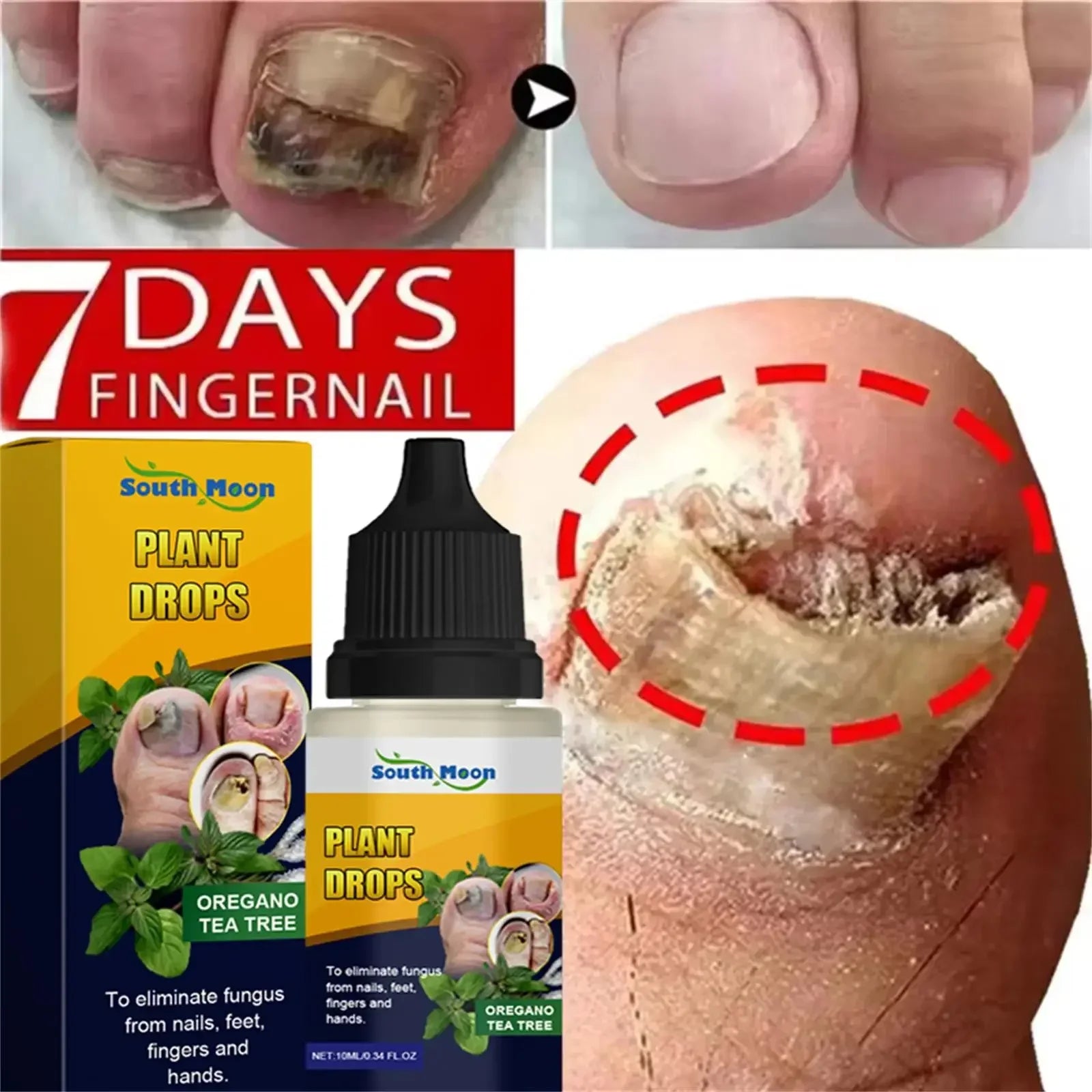 7 Days Nail Repair Serum | Plant Extract Nail Wellness Gel 10ml