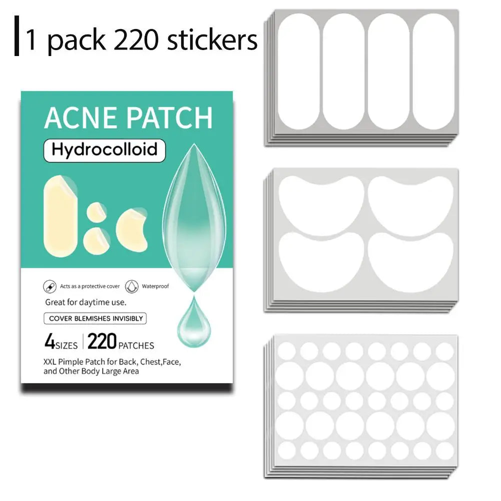 Large Pimple Patches Bulk for Face, 5 Sizes Hydrocolloid Acne Patches for Covering Body, Forehead, Chin Blemishes Zit Breakouts Oasis Select 220pcs