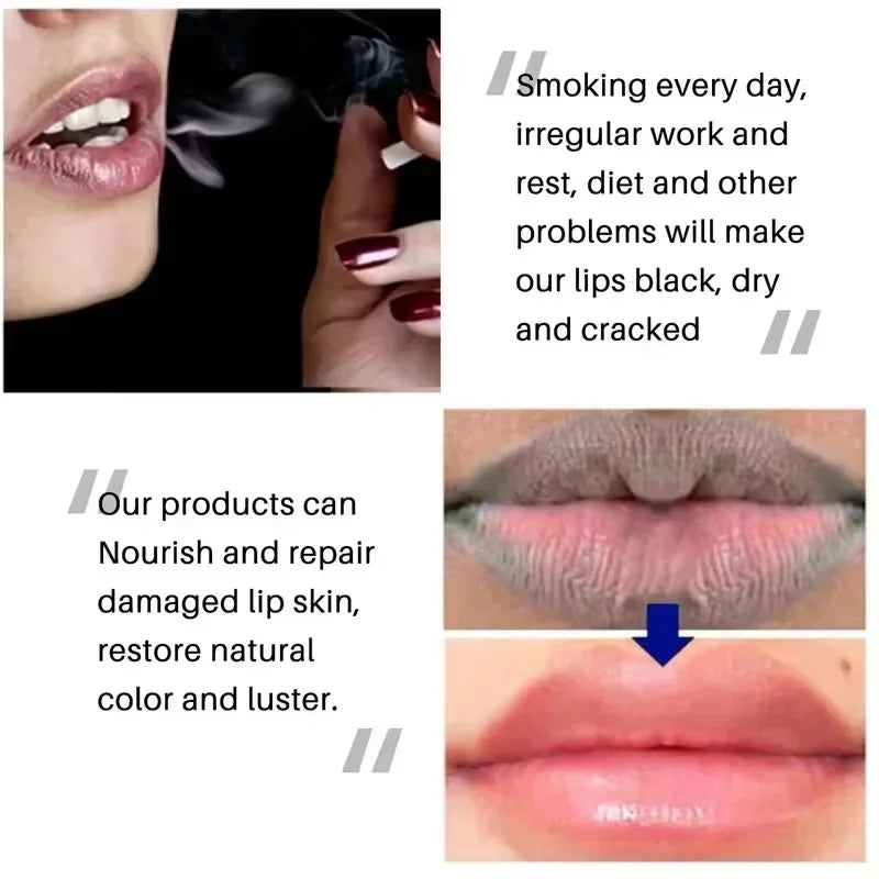 SADOER Brightening Lip Balm – Exfoliate, Moisturize & Lighten Brightening Lip Balm Oasis Select