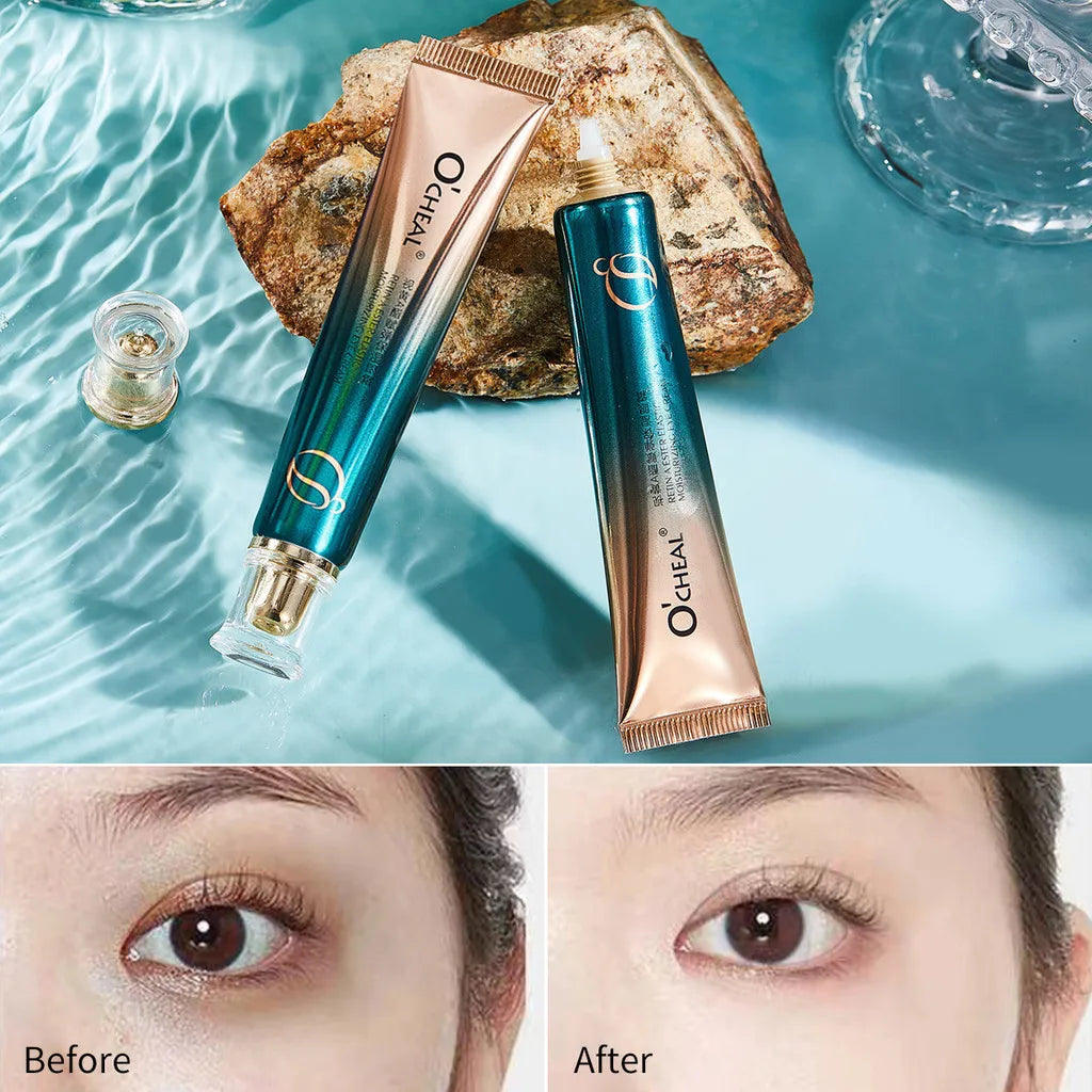 Retinol A Ester Elastic Moisturizing Firming Eye Cream Fading Fine Lines Dark Circles 30g Oasis Select