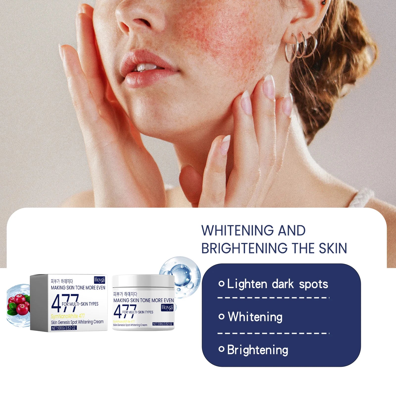 Hoygi Brightening Spot Fade Moisturizer – Dark Spot Cream