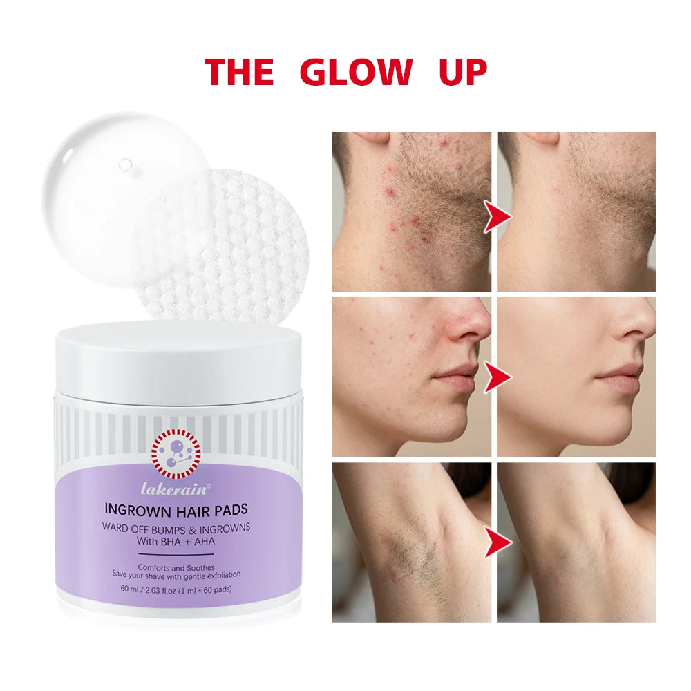 Ingrown Hair Exfoliating Pads | Aftershave Treatment 60 Pads