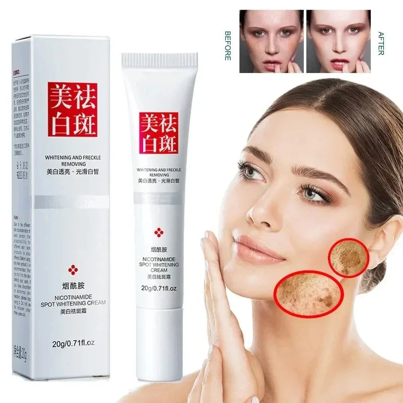 Fades Freckle Dark Spots Face Cream Niacinamide Whitening Cream Vitamin E Improve Dullness Fast Brighten Nourish Skin Care Oasis Select Default Title