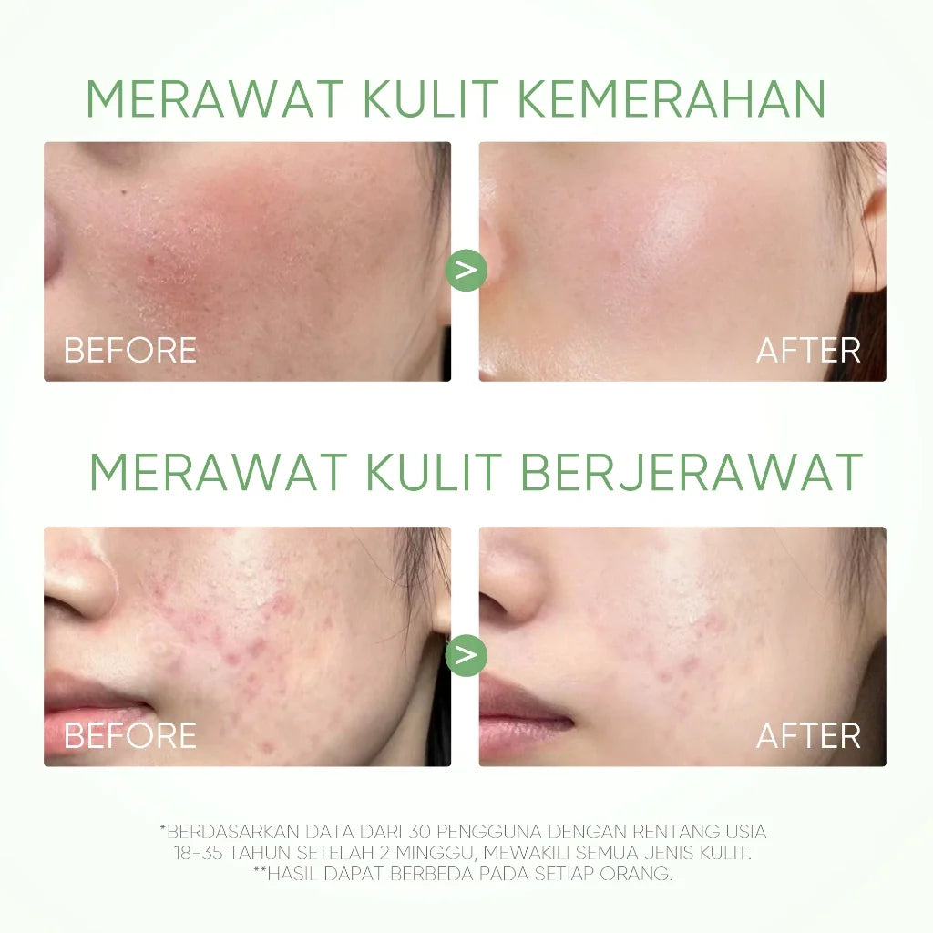 Mugwort Clay Stick Anti-Acne Clay Mask for Clean Pores and Blackheads Improve Acne Prone Skin 40g Oasis Select