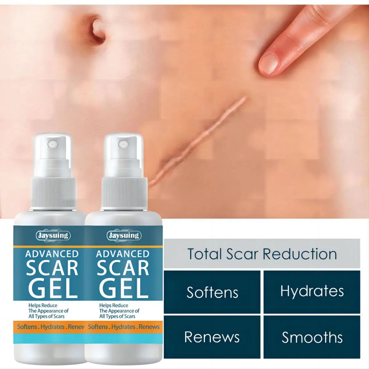 Scar Fade Cream Gel – Stretch Marks & Post-Surgery Skin Smoother