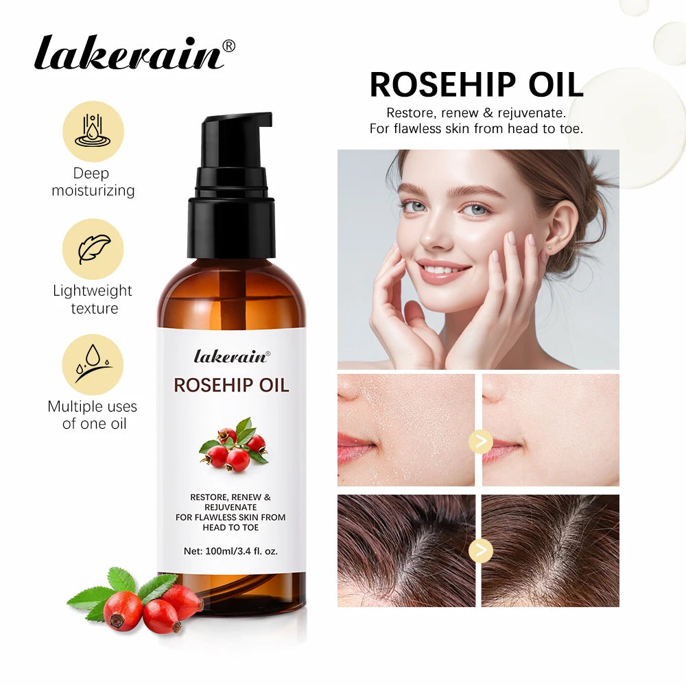 Organic Rosehip Oil Rose Hips Face Oils 30ml Fast-Absorbing Skin Care Moisturizer Face Oil Organic Rosehip Seed Oil Essence Oasis Select
