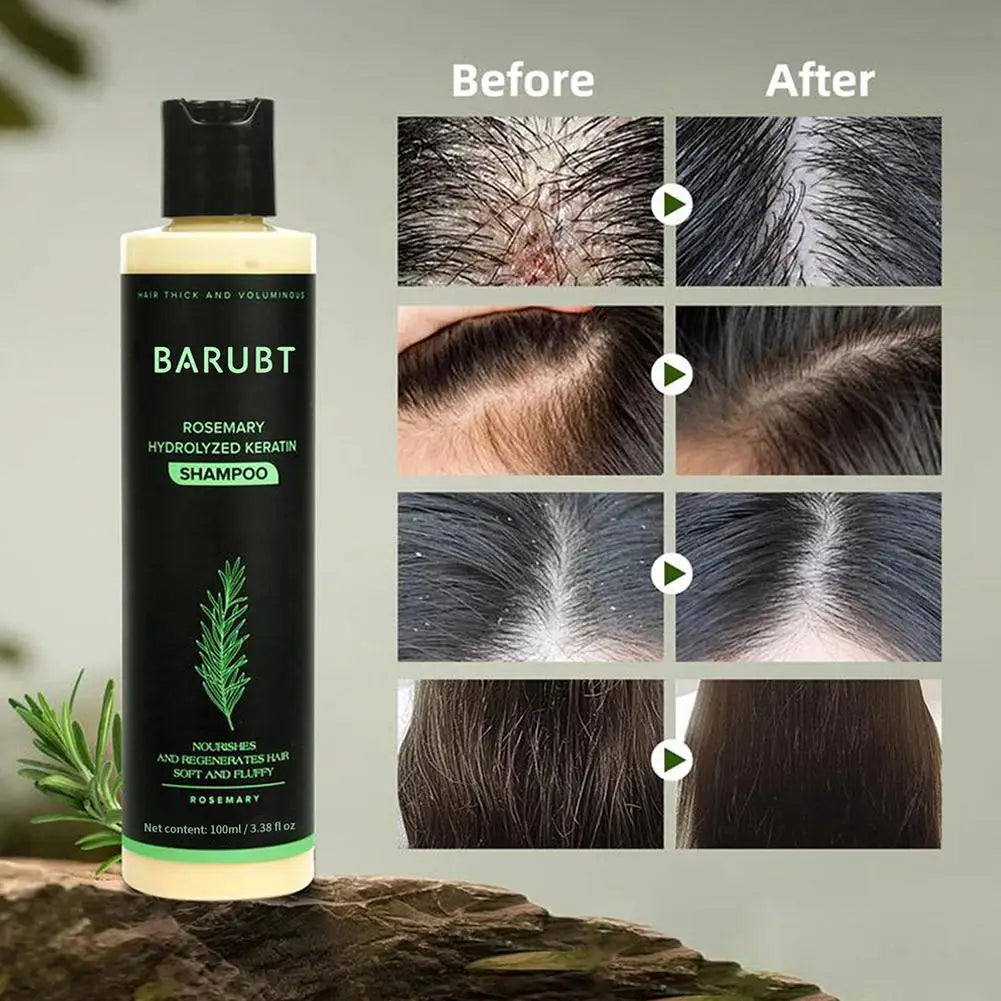 Rosemary Shampoo Hair Growth Deep Cleansing Scalp Anti Dandruff Oil Control Strengthening Root Nourish Hair Volumizing Shampoo Oasis Select