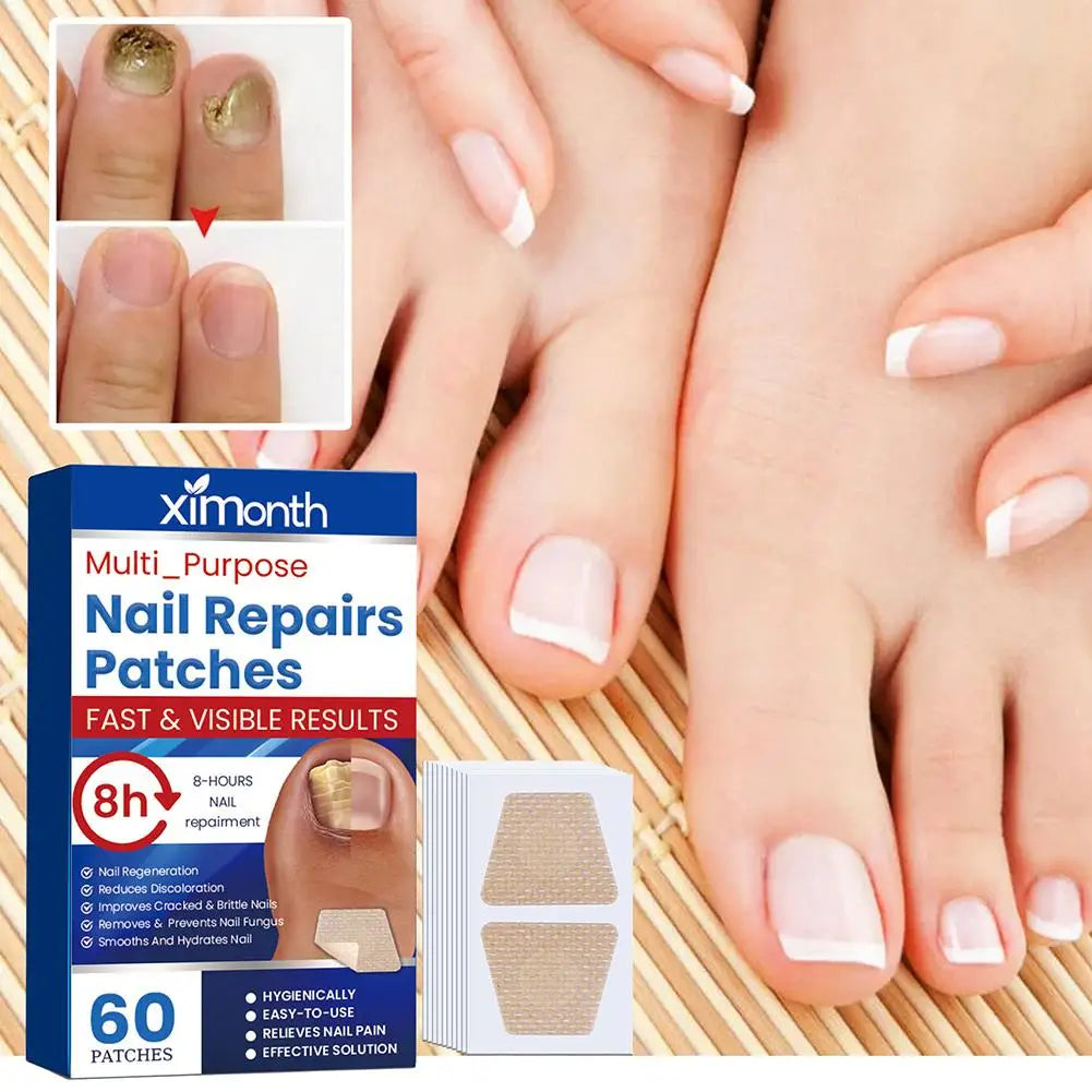 60pcs Toenail Patches Nail Repair Extra Strength Patches For Toenail Fingernail Non-Irritating And Breathable Nail Repair Oasis Select