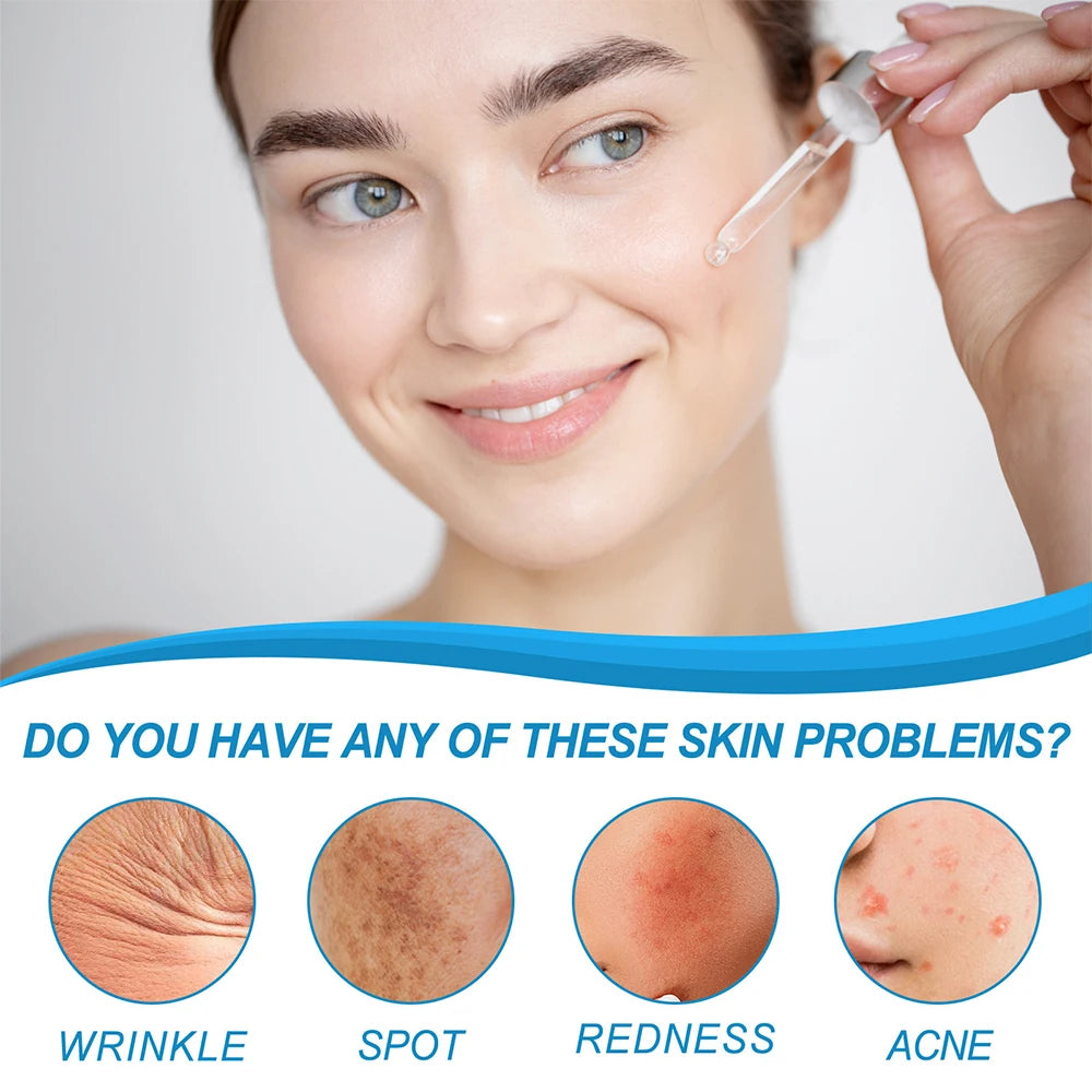 YOUNGCOME HYALU B5 Serum Anti -Wrinkle Collagen Instant Face Tightening Fade Fine Lines Hydrating for Plumping Oasis Select