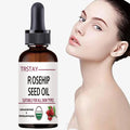 TRSTAY Rosehip Face Oil – Moisturizing & Brightening Serum