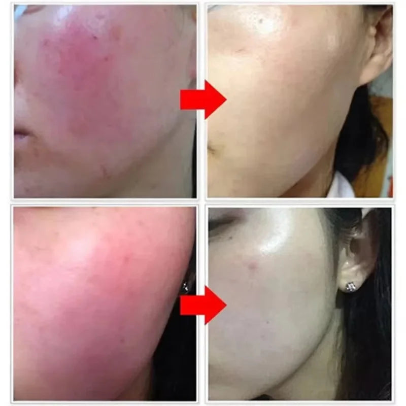 SADOER Calming Face Serum – Sensitive Skin & Pore Minimizer Face Serum Oasis Select