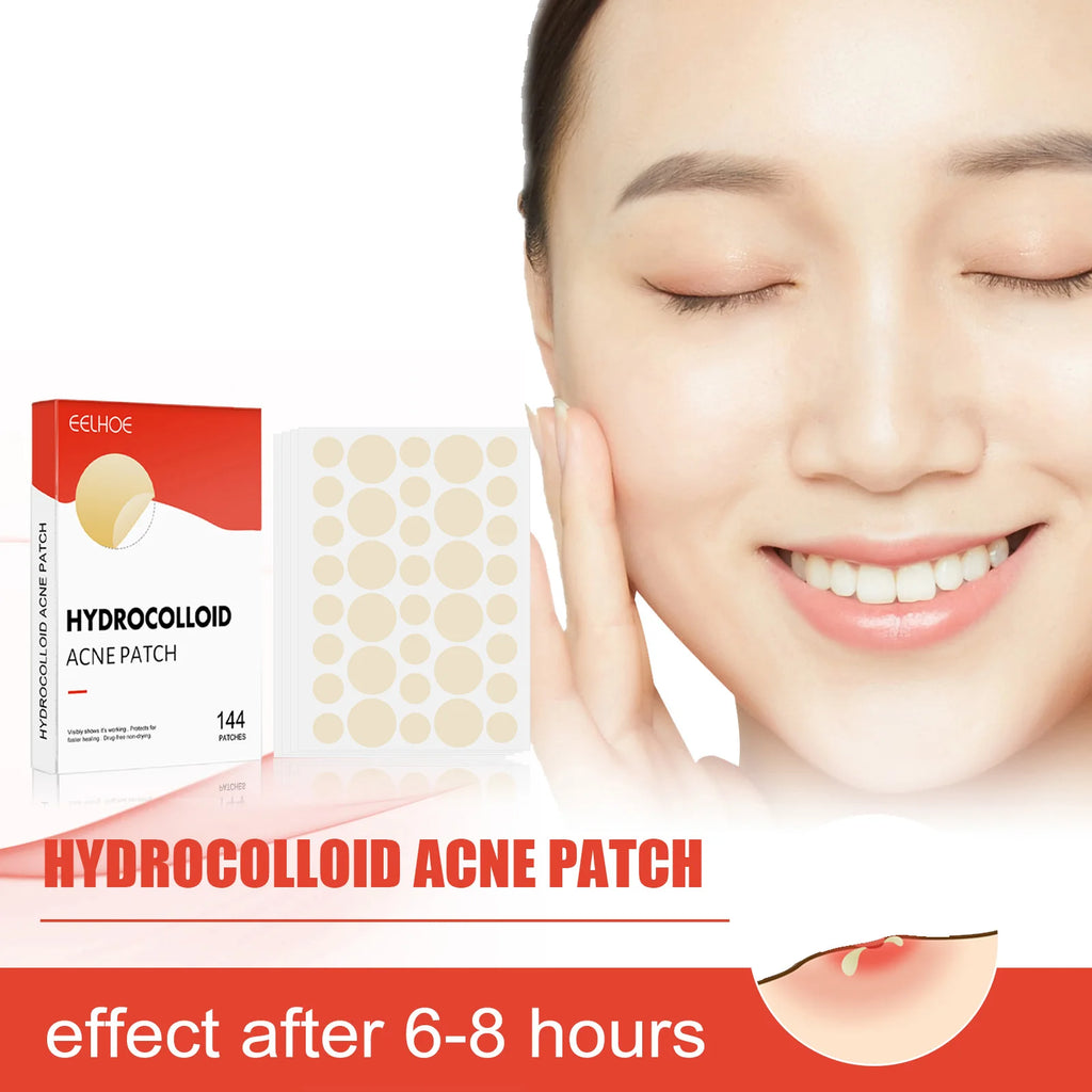 Hydrocolloid Acne Patches 144pc – 2 Sizes, Invisible & Clear Acne Patch Oasis Select