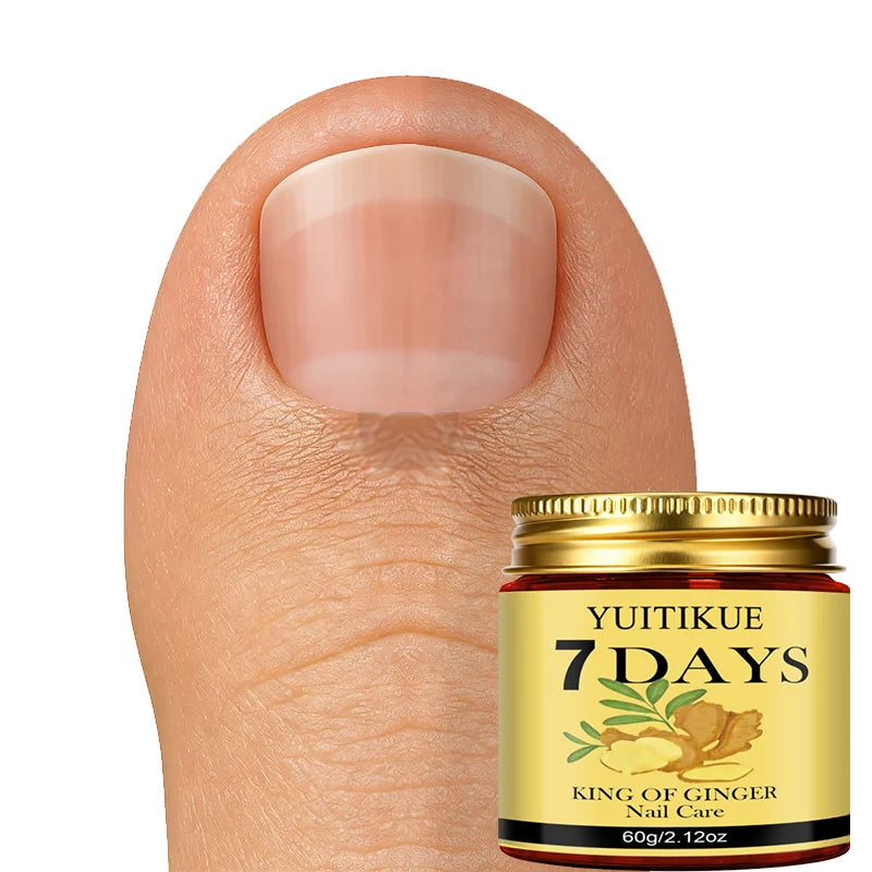 YUITIKUE Ginger King Nail Care Cream – 7-Day Results, 60g