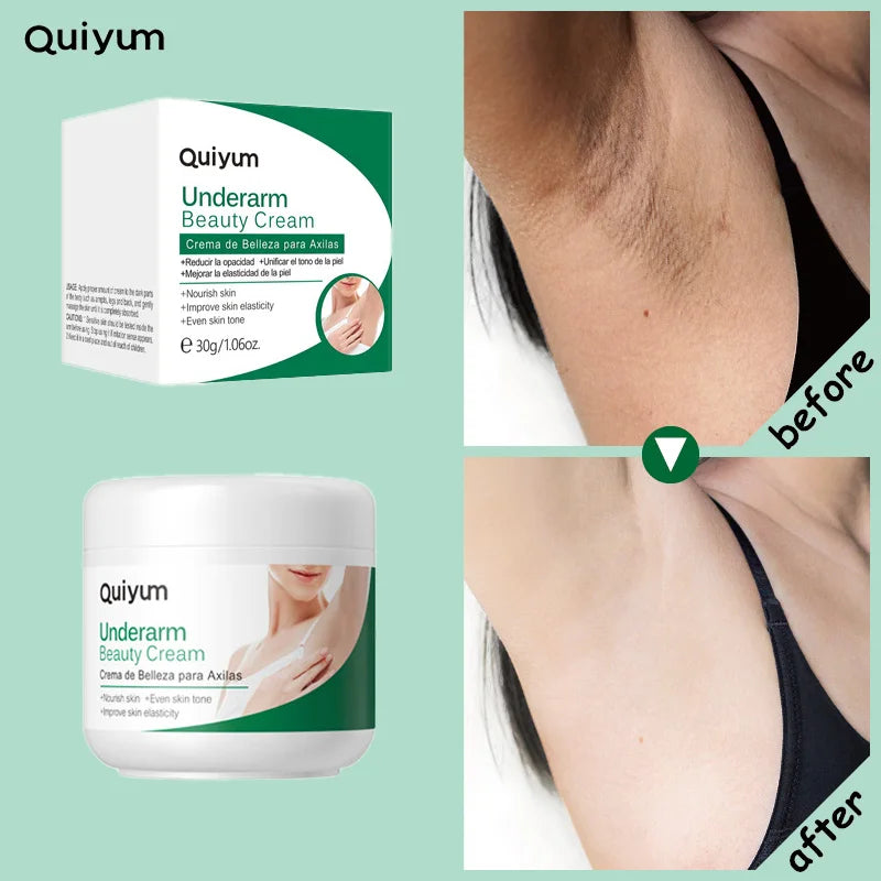 Underarm Care Cream Moisturizing Nourishing Even Tone Improve Elasticity Body Skin Beauty Cream 30g Oasis Select