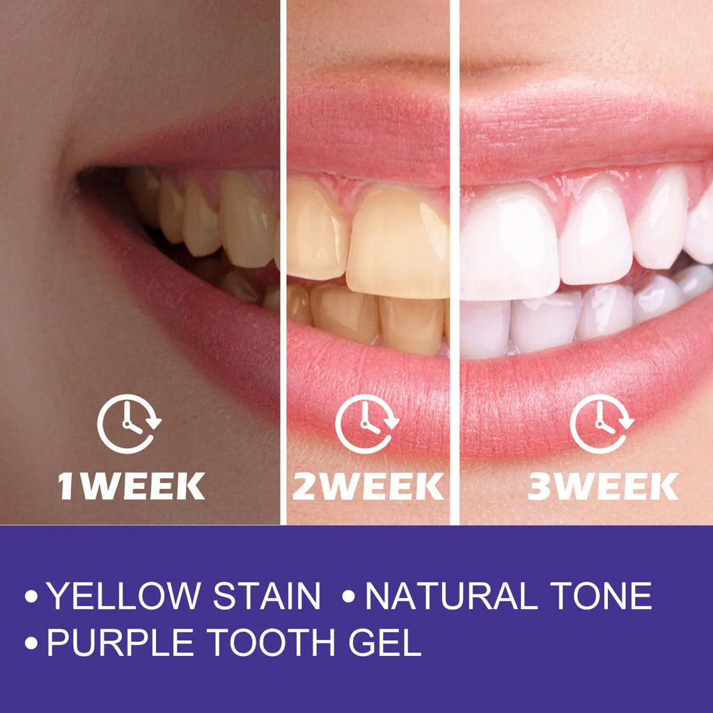 Purple Toothpaste Teeth Whitening Remove Yellow Stains Fights Tartar Fresh Breath Oral Hygiene Teeth Care Cleaning Toothpaste Oasis Select