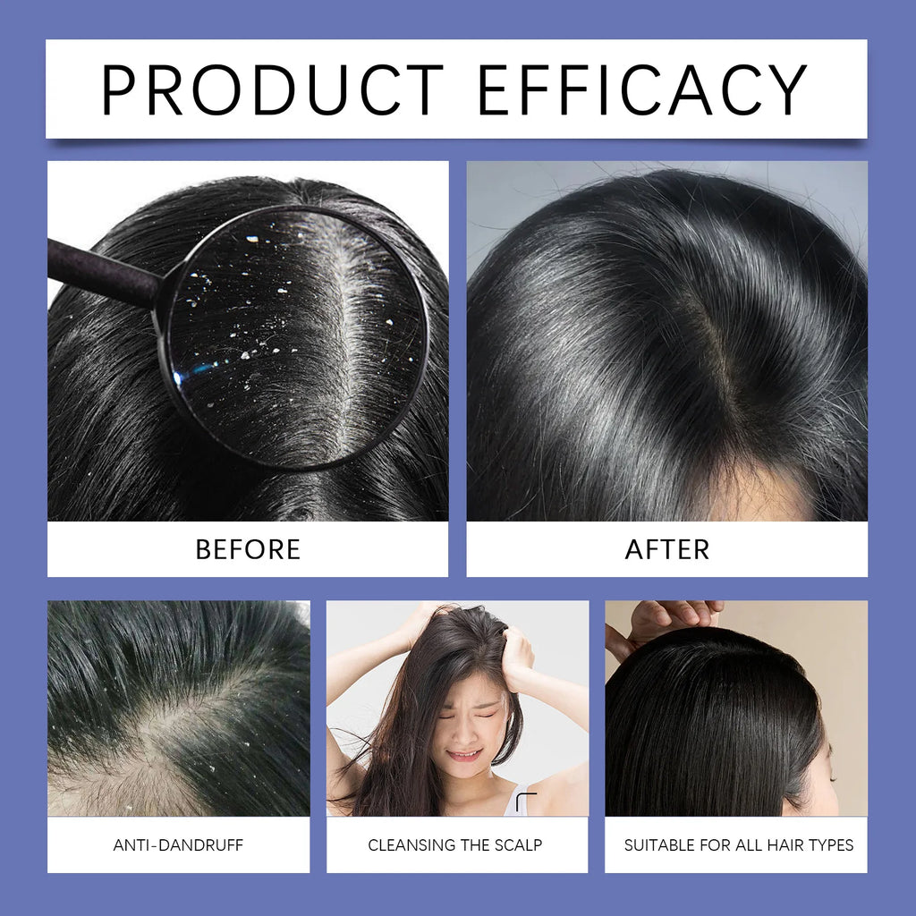 120ml Selenium Sulfide Shampoo Deep Cleansing Remove Dandruff Itchy Balance Oil Nourishing Restoration Hair Color Shampoo Oasis Select