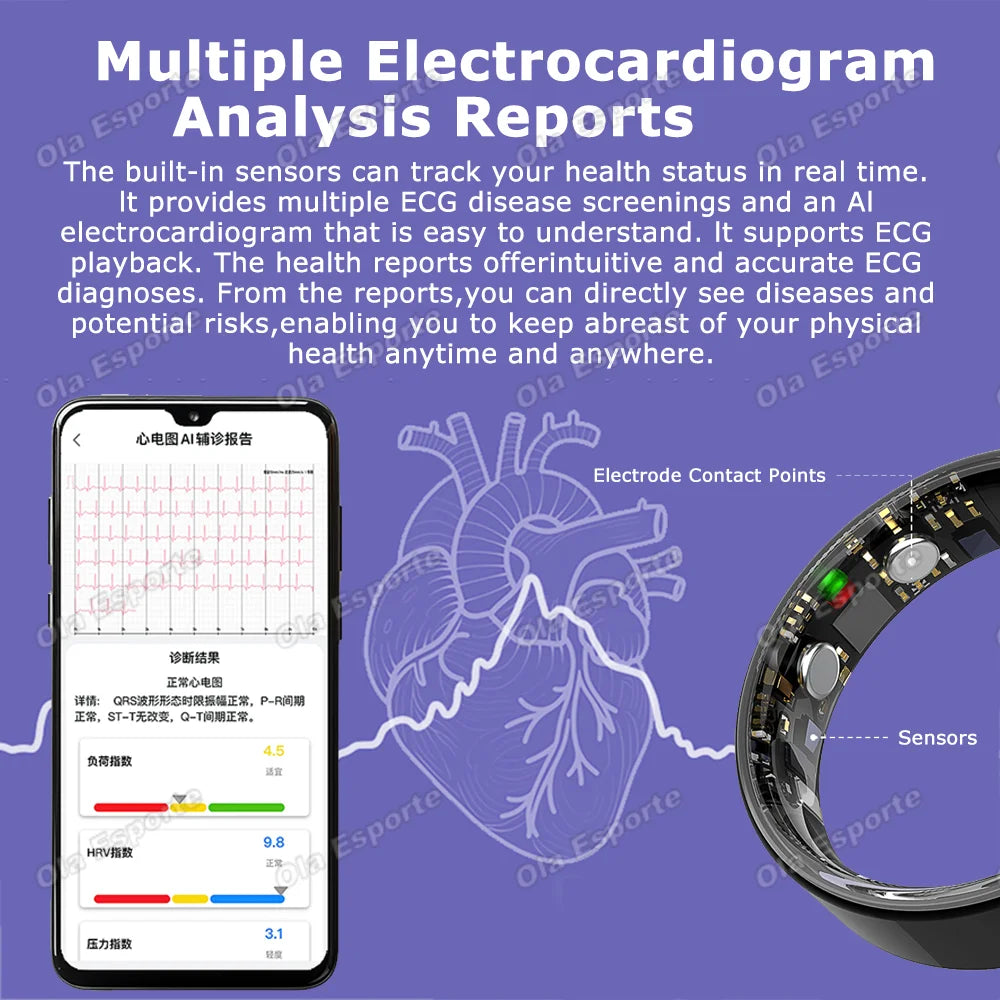 AI ECG Smart Ring – Heart Rate, BP, SpO2 & Sleep Monitor