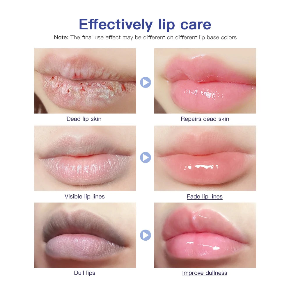 Hose Lip Care Repair Gel Cream Hydrating Hydrating Hydrating Hydrating Dryness Soothing Chapping Hydrating Repair Lip Balm Oasis Select