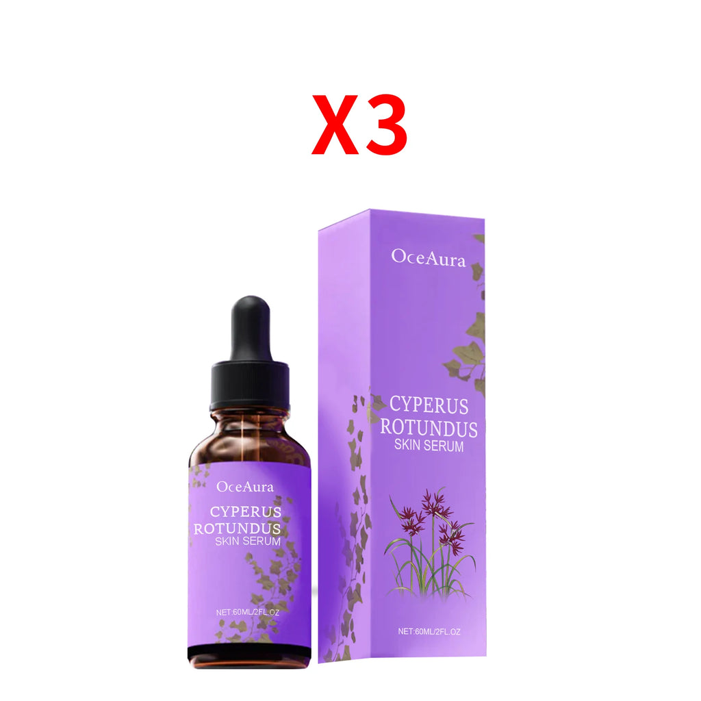 Cyperus Rotundus Serum Hair Growth Inhibitor Soothing Moisturizing Depilatory Refreshing Slowing Reduction Body Hair Growing Oil Oasis Select 180ml boxed
