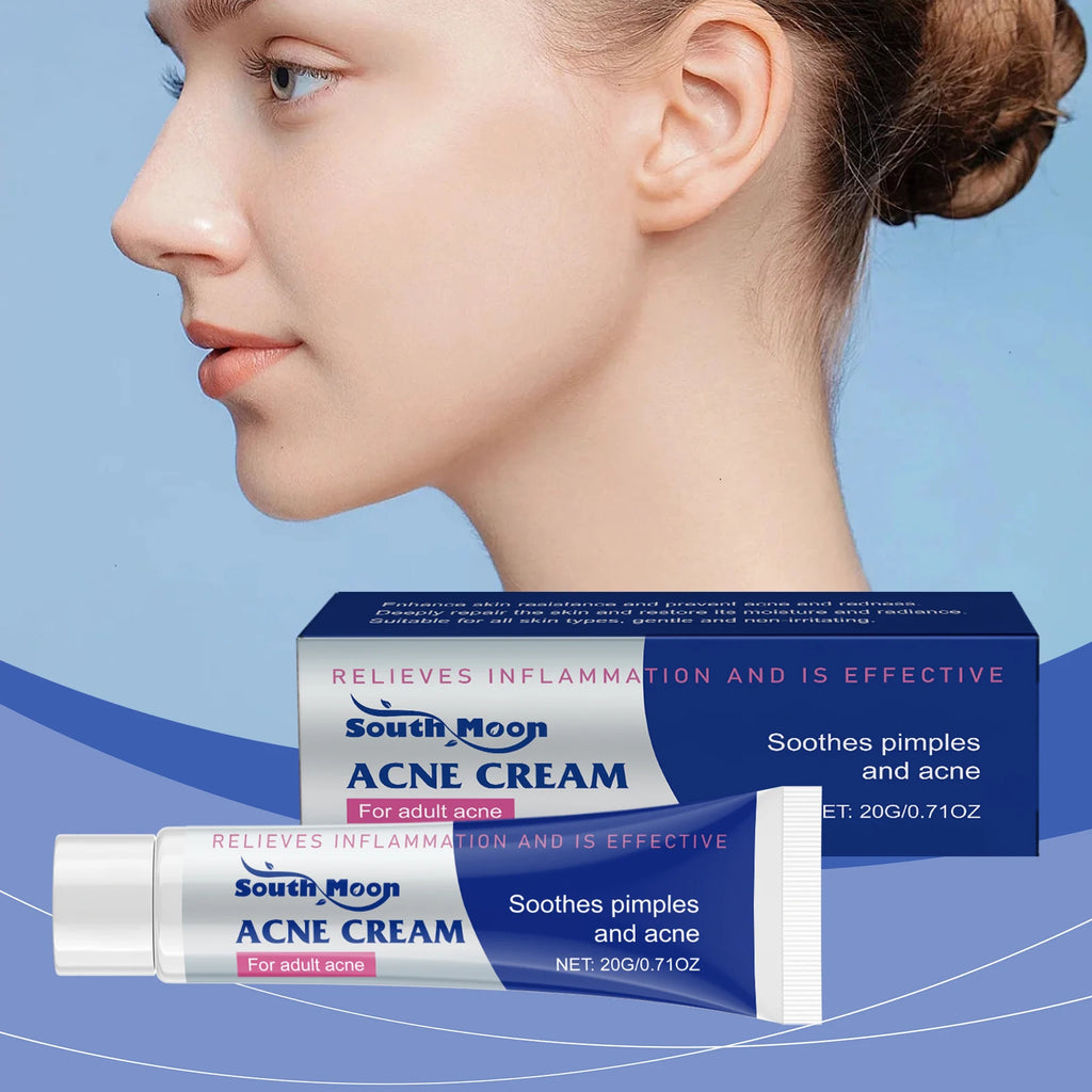20/40/60g Anti Acne Cream Oil Control Repair Pimple Spot Remove Acne Mark Cleaning Refreshing Moisturizer Skin Pore Shrink Cream Oasis Select