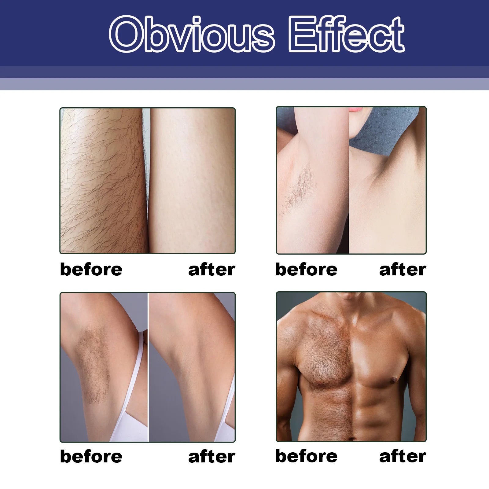Hair Removal Spray for Women and Men, No Irritation Mild Hair Remover for Underarm Arm Back Chest and Legs Fast Acting Removal Oasis Select