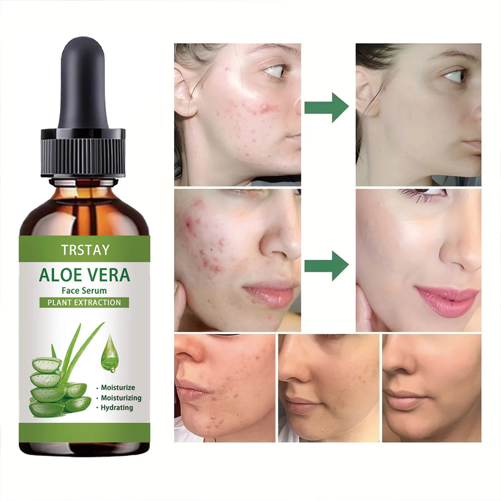 TRSTAY Aloe Vera Face Serum – Moisturizing Anti-Aging Oil