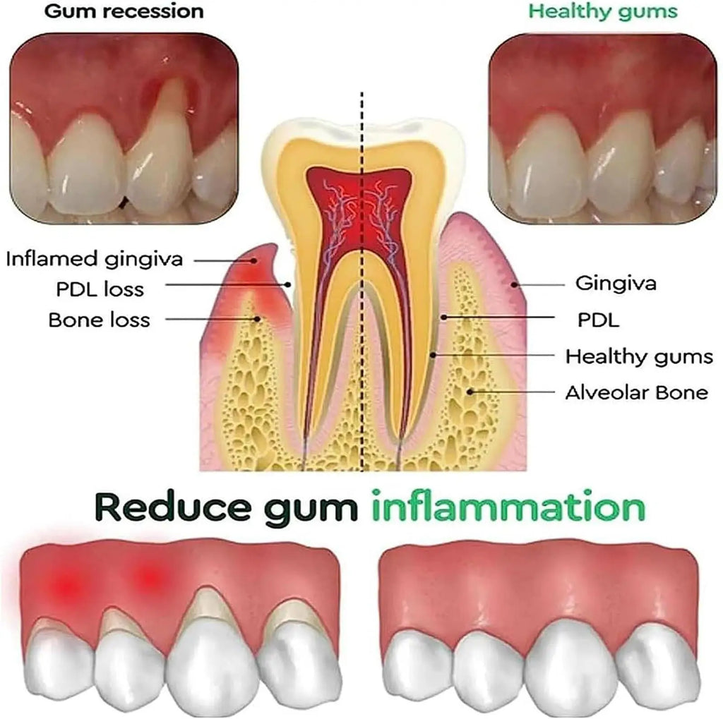Eelhoe Gum Repair Gel Toothpaste – Tartar, Enamel & Gum Care