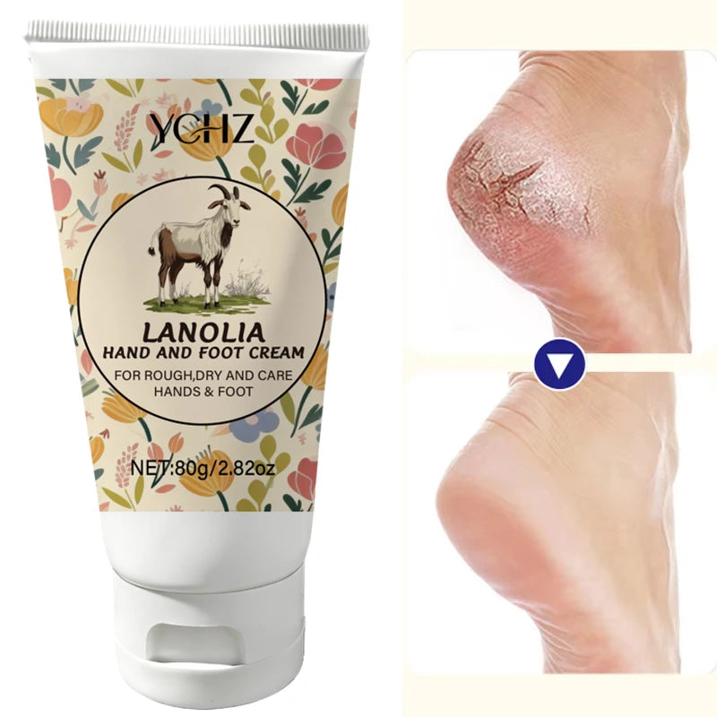 YCHZ Foot Cream – Moisturizer for Dry, Rough & Cracked Heels