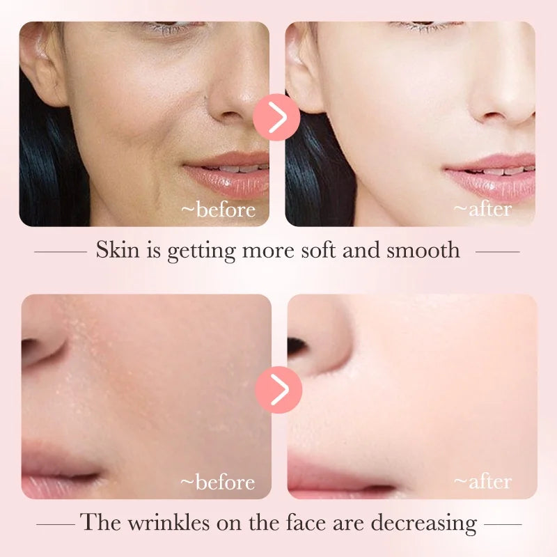 BIOAQUA Niacinamide Serum for Reducing Dark Spots Whitening and Moisturizing Brightening Skin Tone 30ml Oasis Select