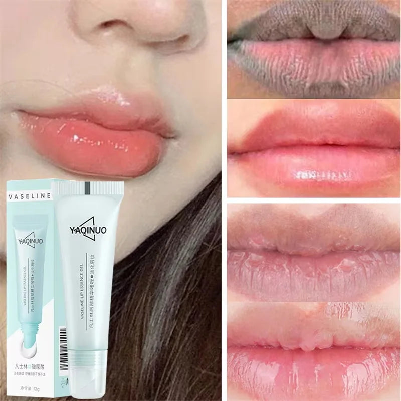 Remove Dark Lip Balm Fast Lightening Pink Lip Exfoliating Fade Lip Line Dead Skin Moisturizer Korean Care Products Beauty Health Oasis Select