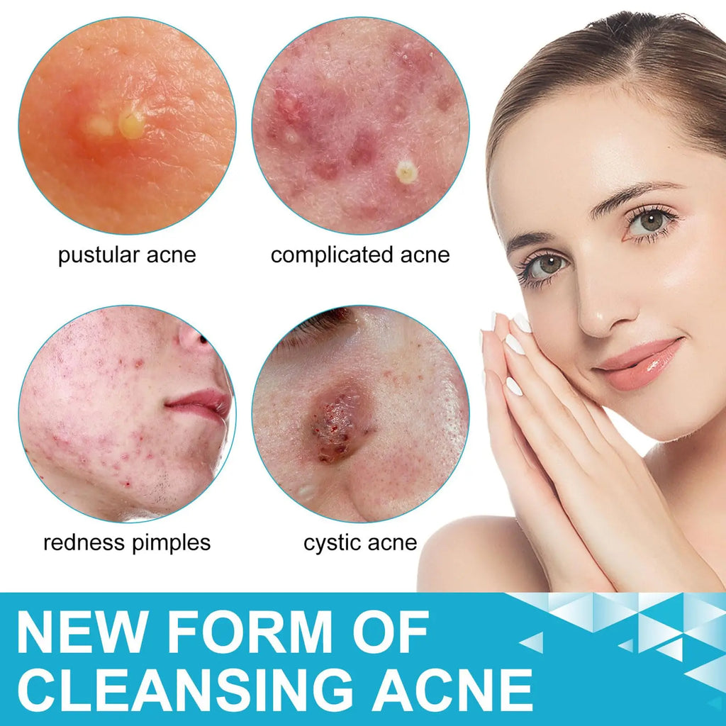Hyaluronic Acid Microneedle Acne Patch – Invisible & Breathable