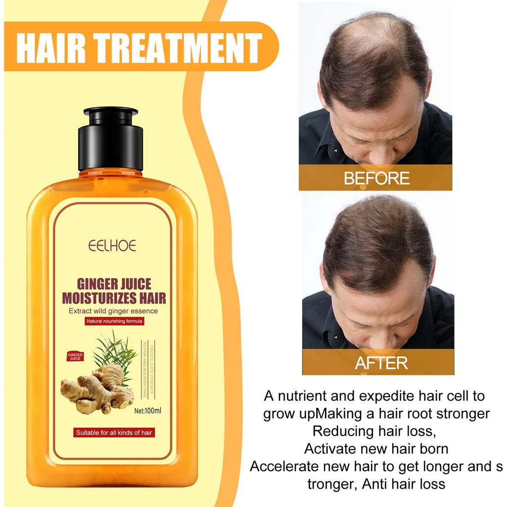 EELHOE Anti Hair Loss Shampoo Ginger Ingredient Strengthening Hair Root Nourishing Dryness Hair Damaged Repair Thicker Treatment Oasis Select