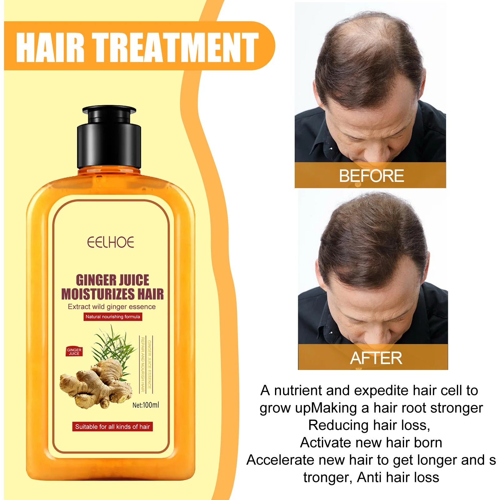 EELHOE Anti Hair Loss Shampoo Ginger Ingredient Strengthening Hair Root Nourishing Dryness Hair Damaged Repair Thicker Treatment Oasis Select