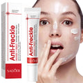 Whitening Cream Anti Freckle Face Cream, Remove The Black ，Melasma Dark Spot Acne Deposits On The Skin，Brightening Skin Care Oasis Select Default Title