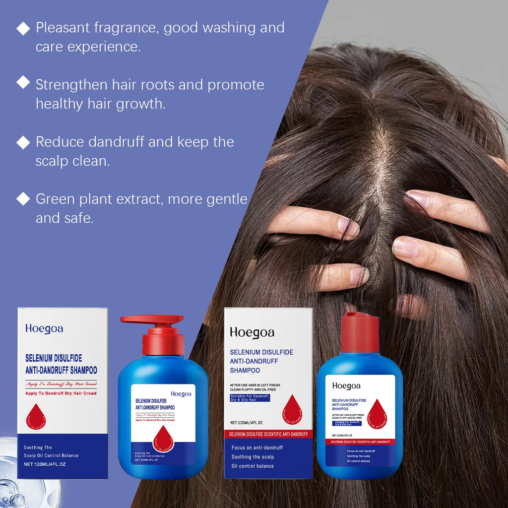 Selenium Sulfide Shampoo Deep Cleansing Remove Dandruff Reduce Scalp Itchy Balance Oil Strengthen Hair Roots Fluffy Hair Shampoo Oasis Select