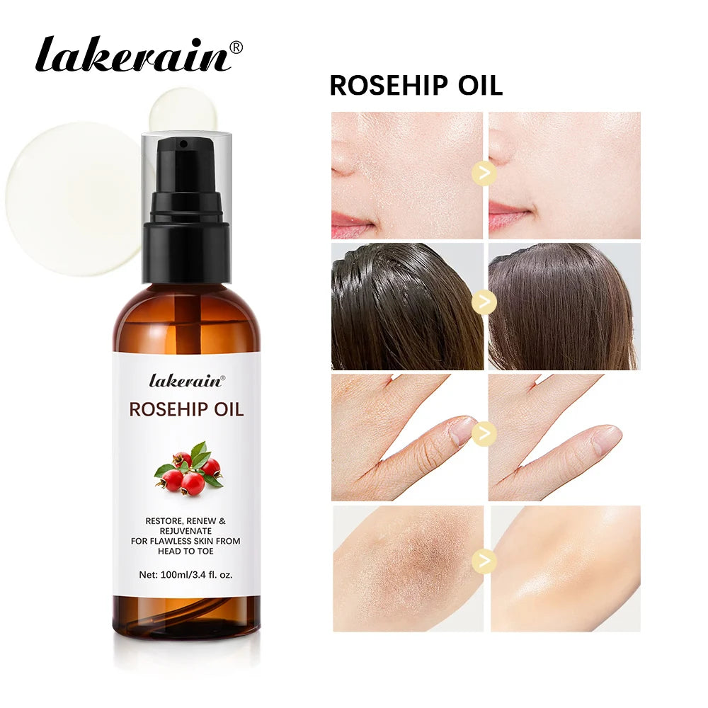 Organic Rosehip Oil Rose Hips Face Oils 30ml Fast-Absorbing Skin Care Moisturizer Face Oil Organic Rosehip Seed Oil Essence Oasis Select 100ml