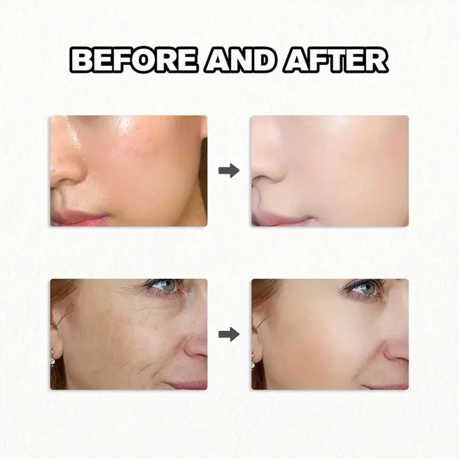 Bee Venom & Retinol Face Serum – Anti-Aging & Brightening Anti-Aging Face Serum Oasis Select