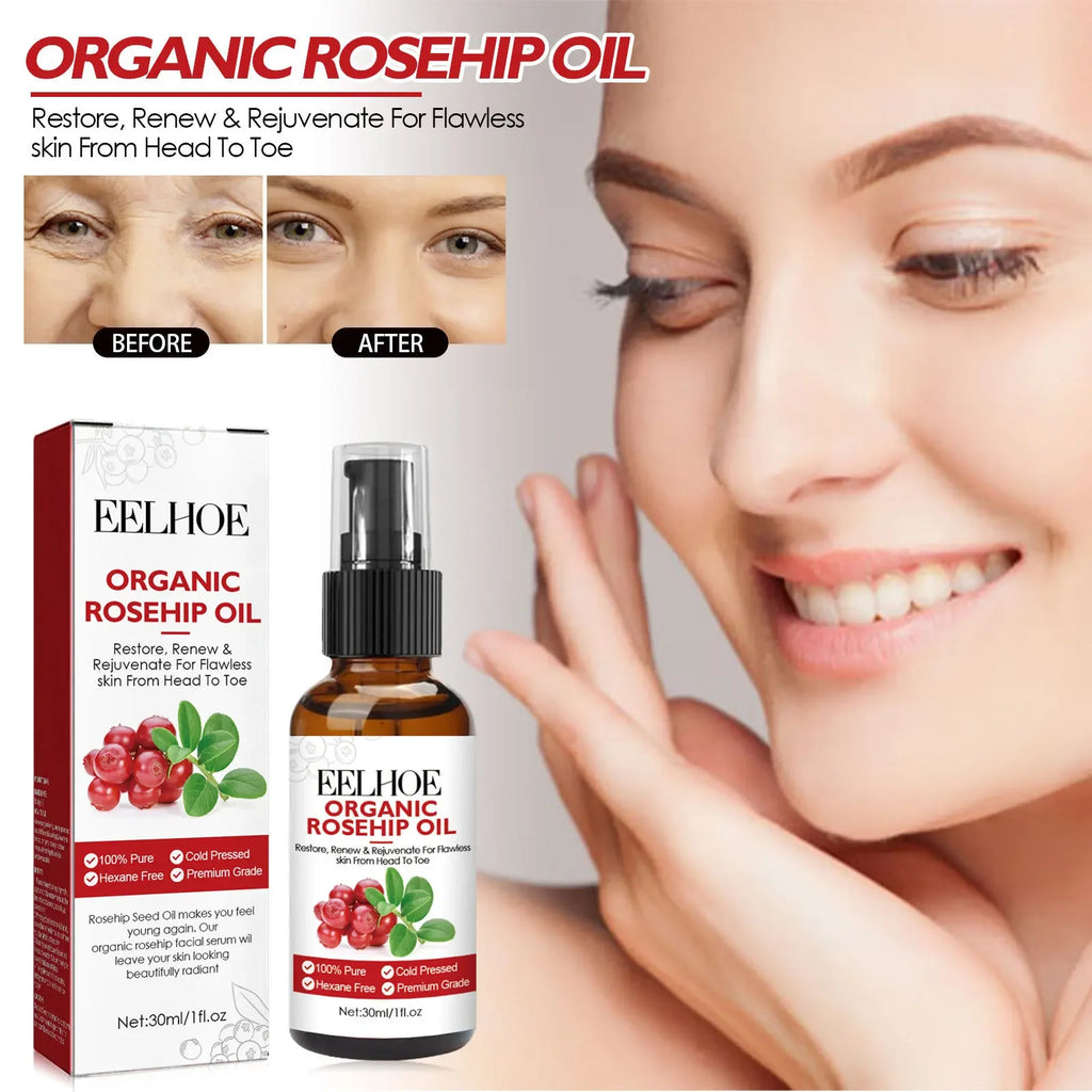30ml Rosehip Oil Facial Serum Moisturizing and Fading Wrinkles Organic Face Serum Fine Pore Anti-aging Essential Oil Oasis Select