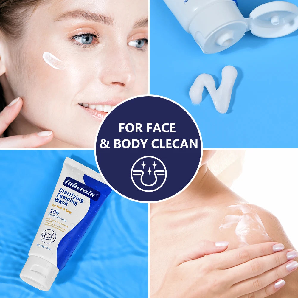 Acne Foaming Wash Benzoyl Peroxide 10% Maximum Antimicrobia Moisturizers reduces redness For Face & Body Skin Care Face Wash Oasis Select