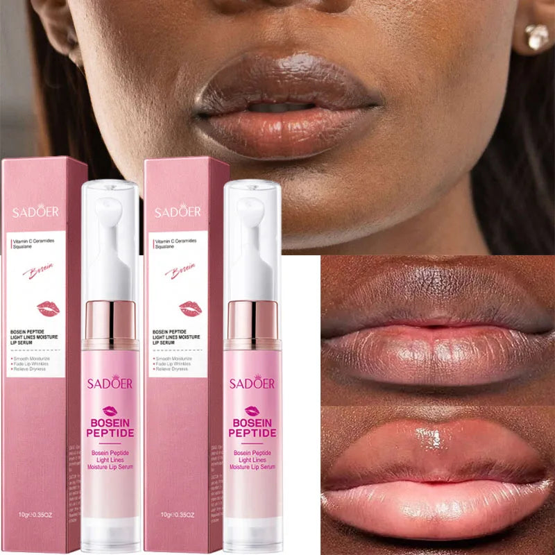 SADOER Lip Lightening Balm – Exfoliating & Brightening Lip Lightening Balm Oasis Select