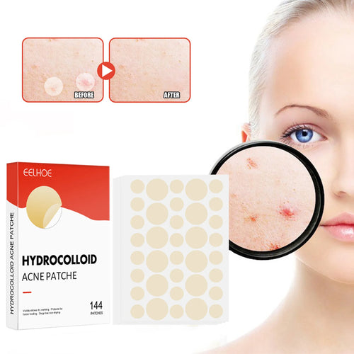 144pcs/set Face Skin Care Acne Pimple Patch 2 Sizes Invisible Professional Healing Absorbing Spot Sticker Covering for Men Women Oasis Select