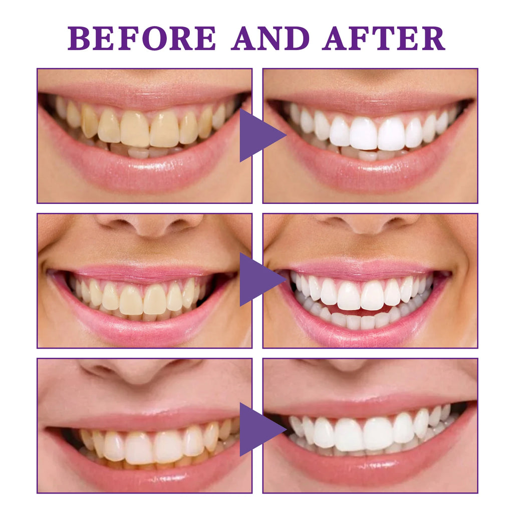 V34 Cleansing Mousse, Intensive Teeth Whitening, Gentle Gum Care & Long-Lasting Fresh Breath, Convenient Press-Type Toothpaste Oasis Select