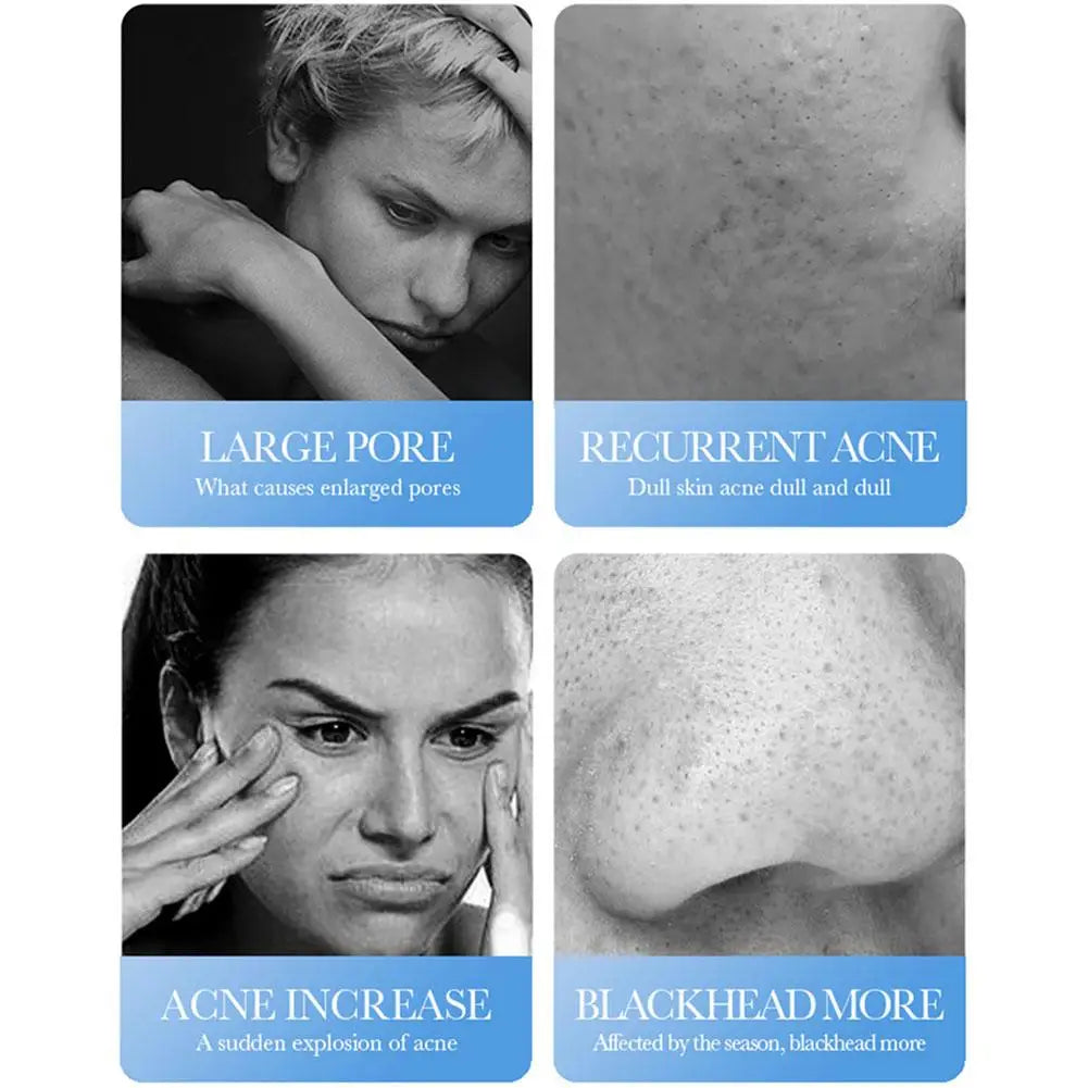 BIOAQUA Salicylic Acid Face Cream Acne Treatment Scar Mark Repair Moisturizing Blackhead Remover Facial Cleanser Skin Care Oasis Select