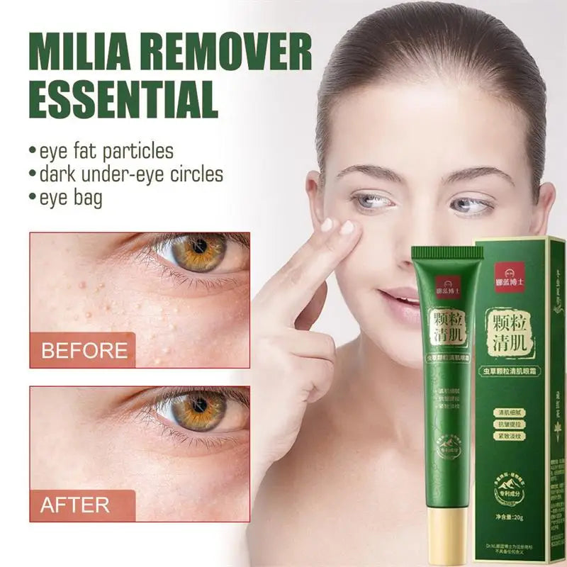 Fat Granules Remover Eye Cream Anti-Puffiness Anti Inflammatory Reduce Dark Circles Eyebags Fade Lines Moisturizing Eye Care Oasis Select