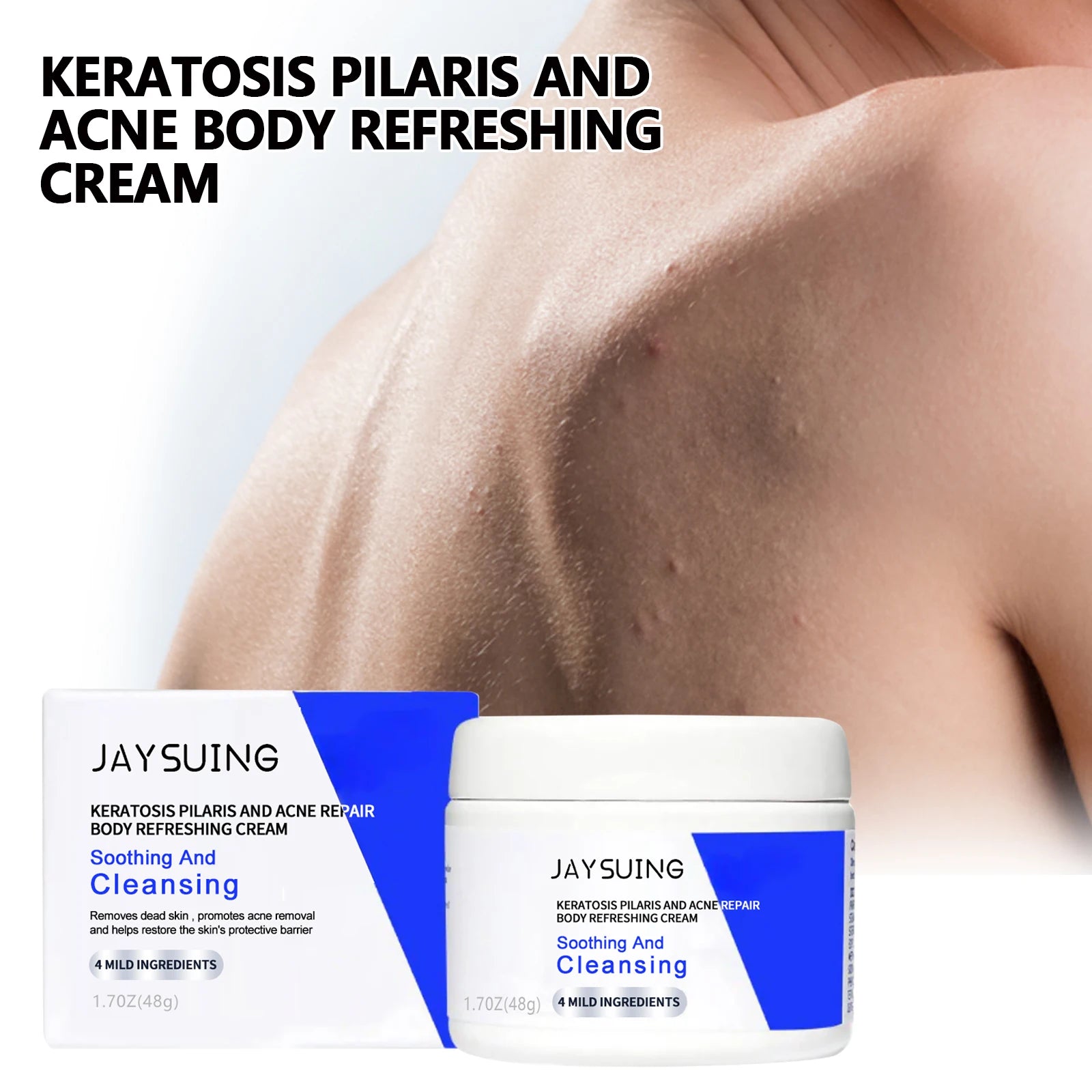 Keratosis Pilaris Repair Cream – Smooth Bumpy Chicken Skin Body Repair Cream Oasis Select