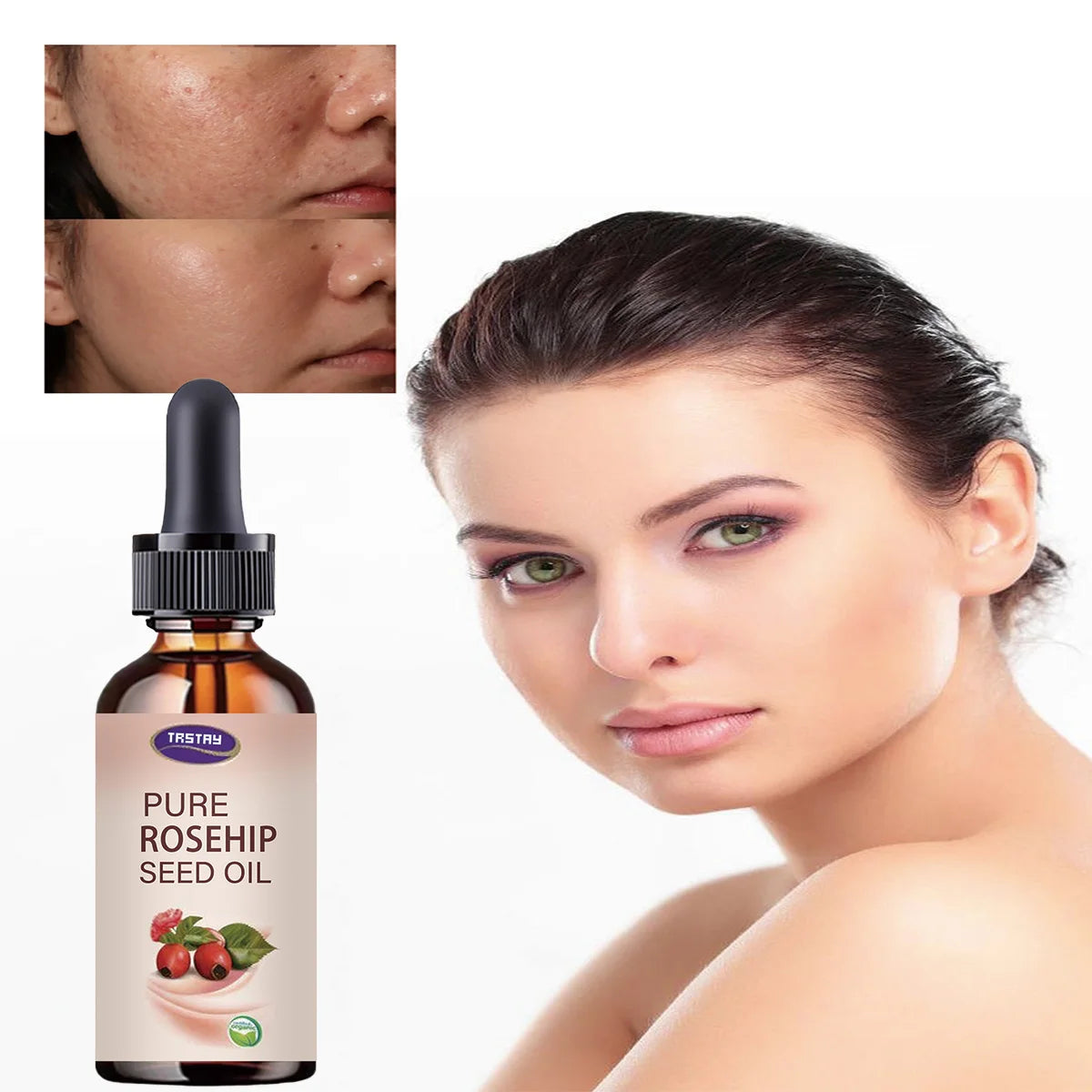5ML/15ML/30ML/50ML/óleo de semente de rosa mosqueta pura reparação óleo de essência hidratante Oasis Select